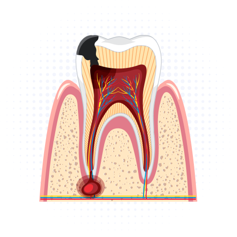 Bright Dental Care And Implant Center