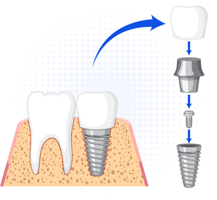 Bright Dental Care And Implant Center